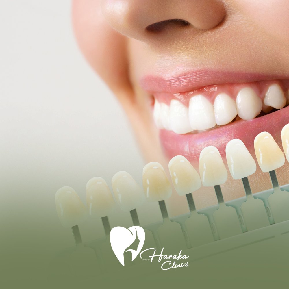 افضل تركيبات زيركون جدة