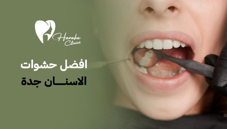 افضل حشوات الاسنان جدة