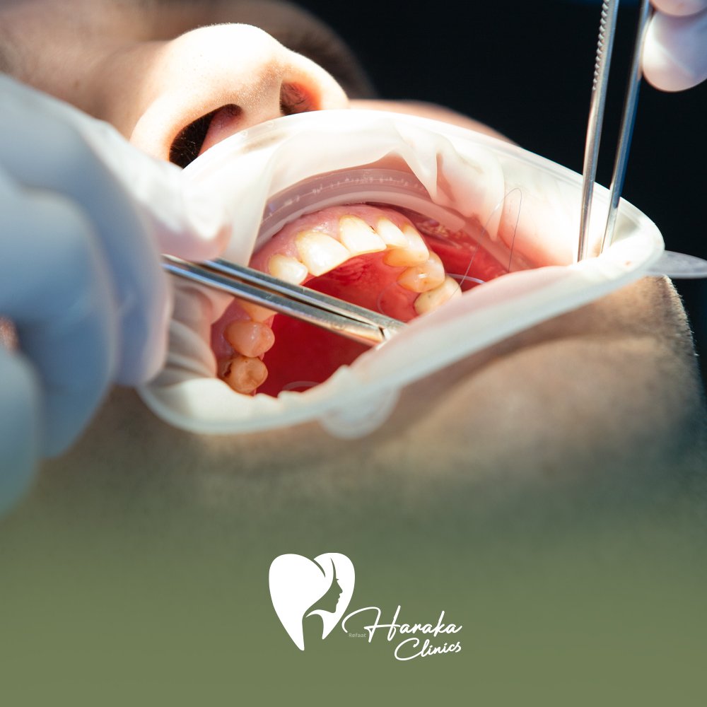 افضل طبيب اسنان في جدة