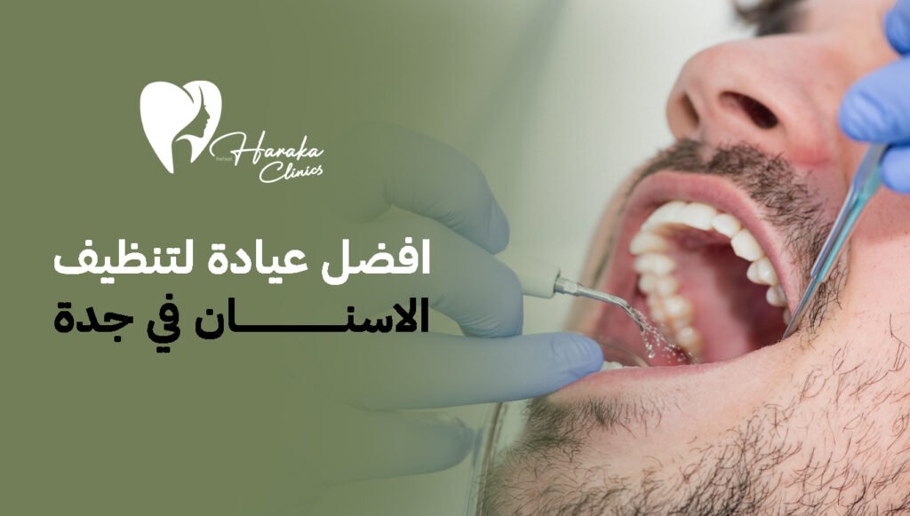 افضل عيادة لتنظيف الاسنان في جدة 2026: دليل شامل للعناية الاحترافية