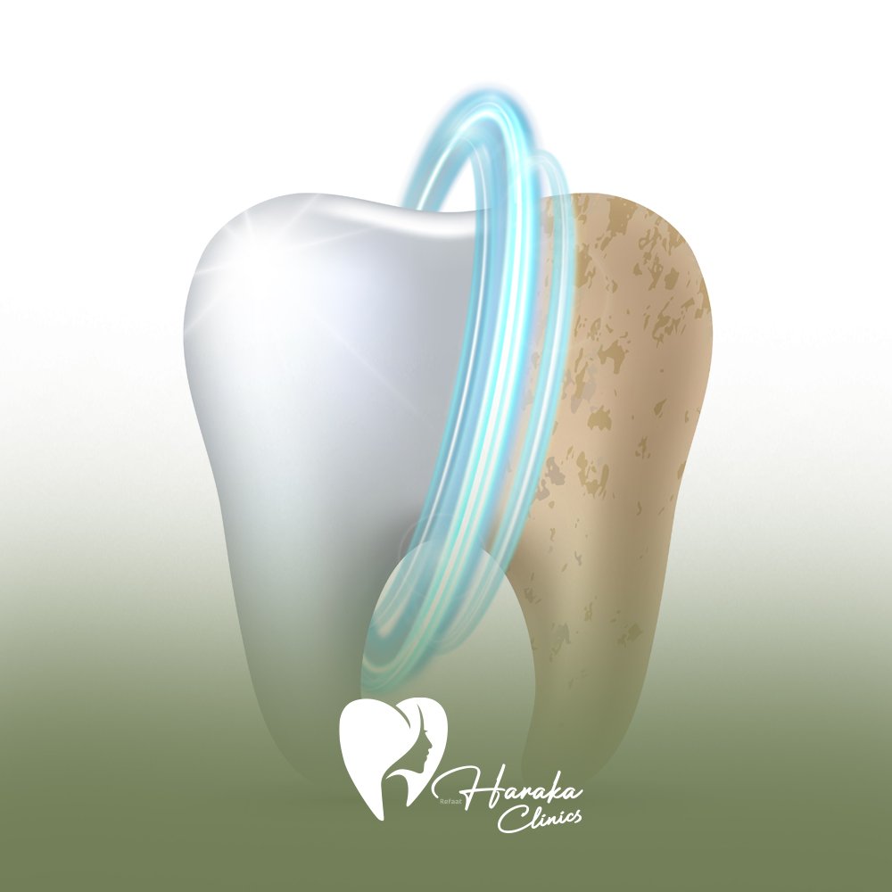 افضل عيادة لتنظيف الاسنان في جدة