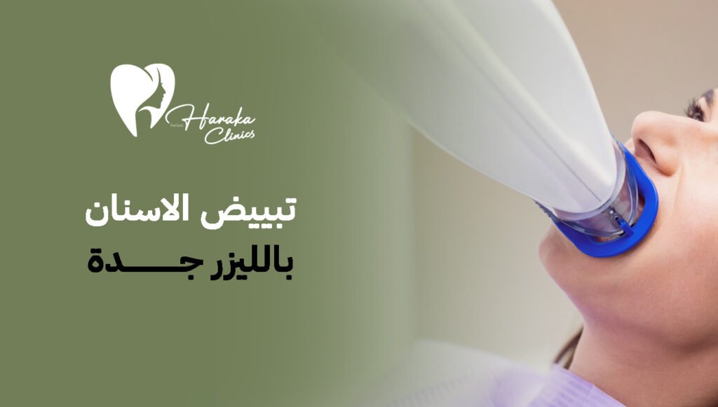 تجربتي مع تبييض الاسنان بالليزر جدة 2026 وأهم المميزات والخطوات