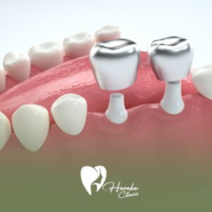 تركيبات ثابته