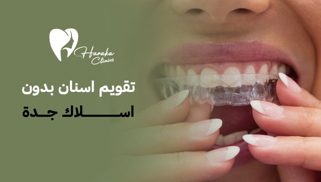 تقويم اسنان بدون اسلاك جدة: الحل الأمثل لابتسامة طبيعية وجذابة