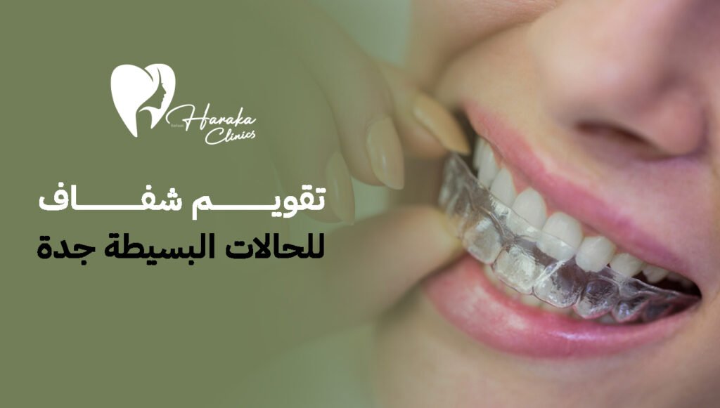 تقويم شفاف للحالات البسيطة جدة – ابتسامة مثالية بدون تقويم معدني