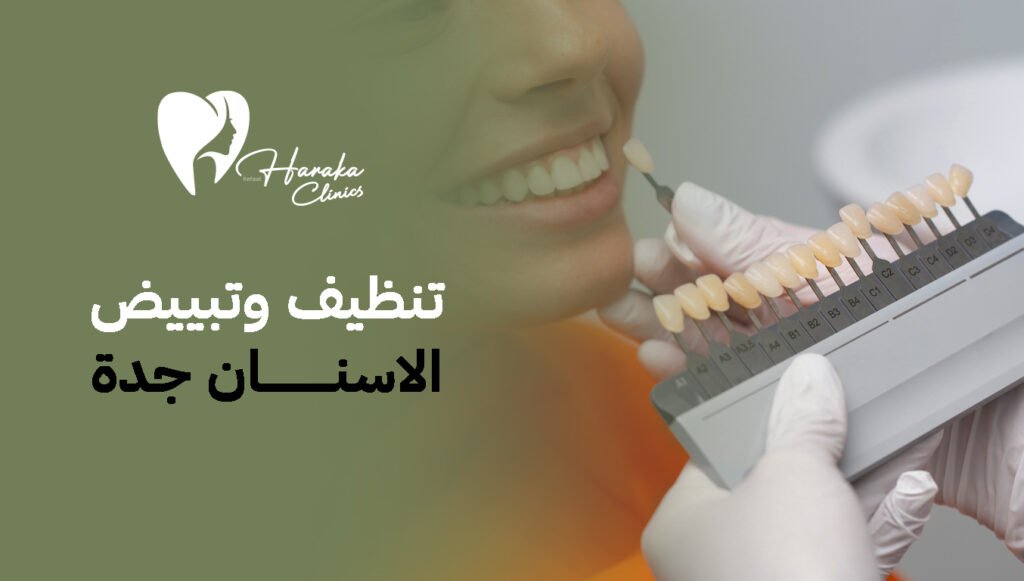 تنظيف وتبييض الاسنان جدة، سر الابتسامة المشرقة التي تبدأ من العناية الصحيحة