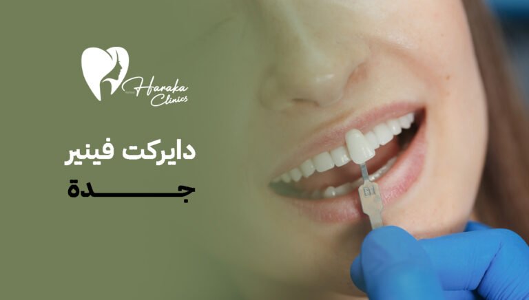 دايركت فينير جدة