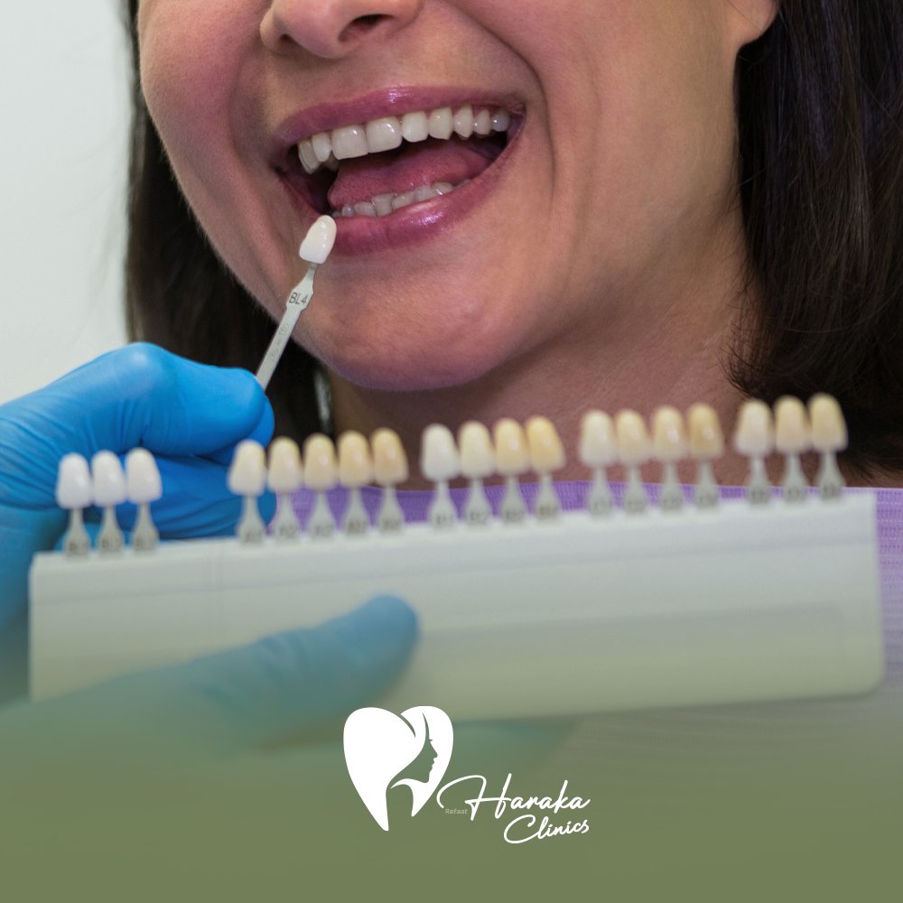 دايركت فينير جدة