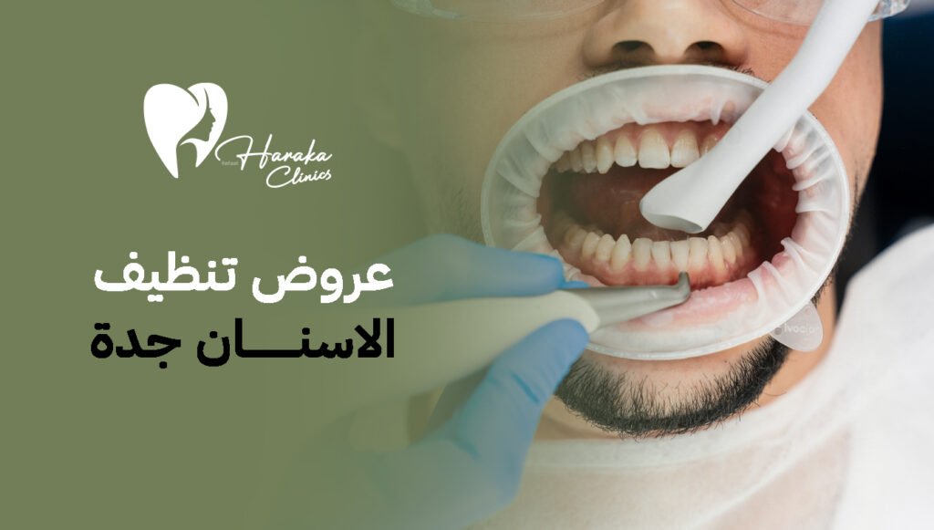 عروض تنظيف الأسنان جدة، سر الابتسامة الصحية التي تدوم