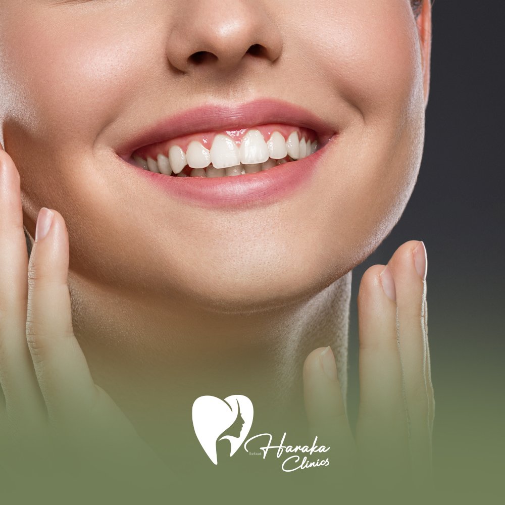 عروض تنظيف الاسنان جدة