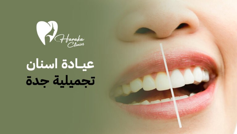 عيادة اسنان تجميلية جدة