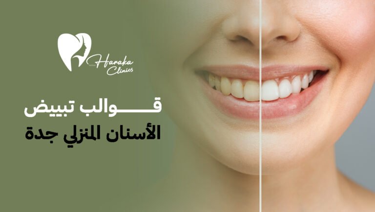 قوالب تبييض الأسنان المنزلي جدة