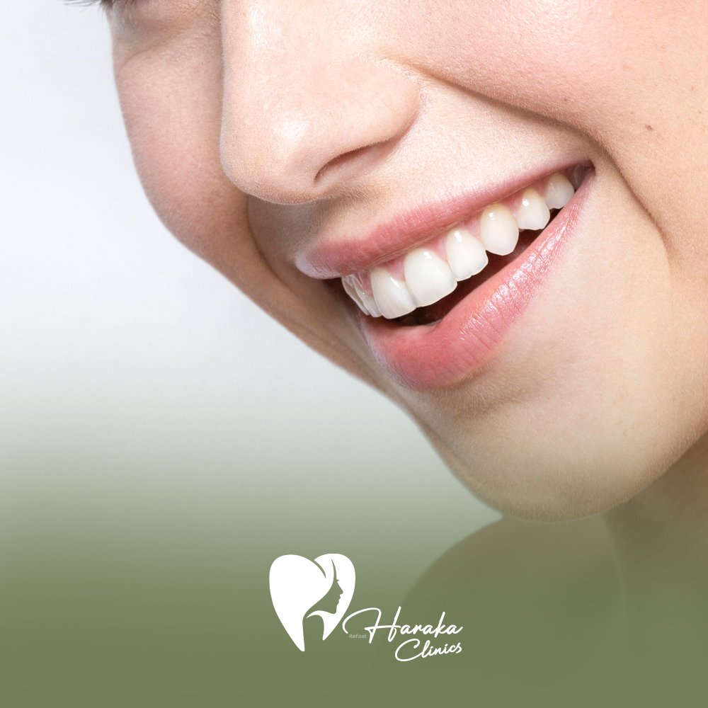 قوالب تبييض الأسنان المنزلي جدة