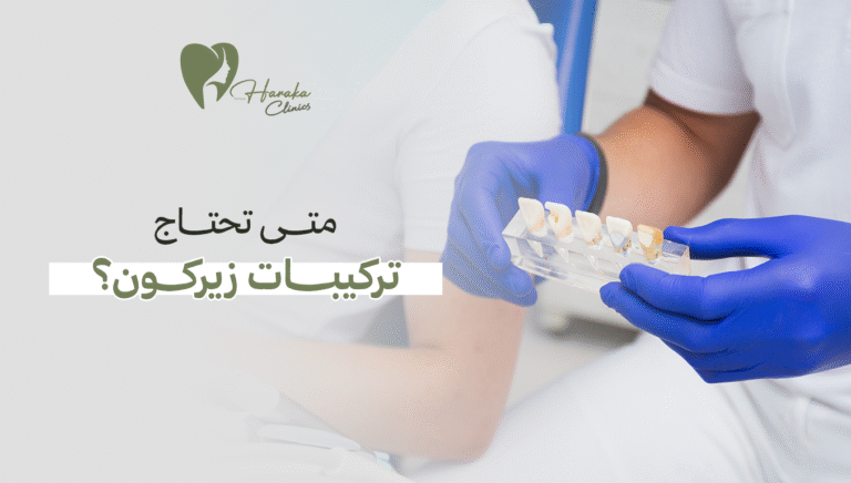 متى تحتاج تركيبات زيركون؟