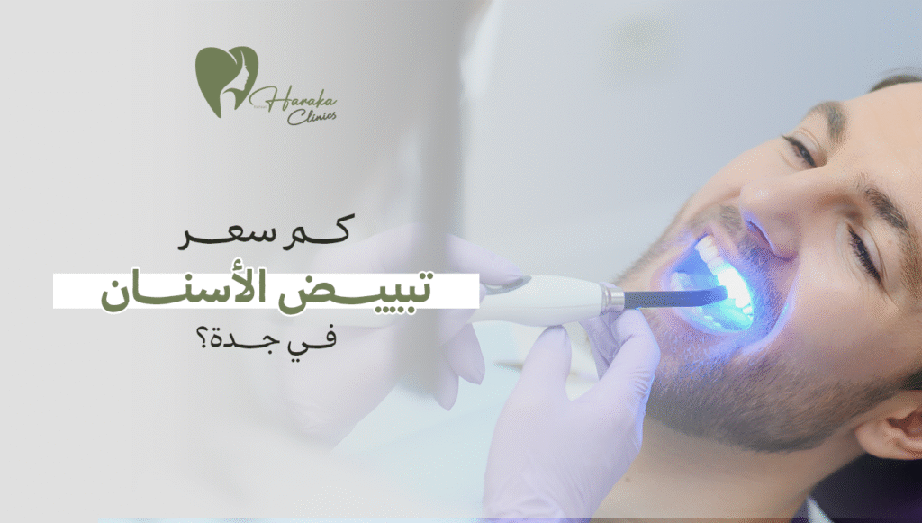 كم سعر تبييض الأسنان في جدة؟ – احصل على عرض مميز الآن!