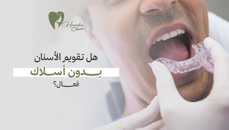 هل تقويم الأسنان بدون أسلاك فعال؟