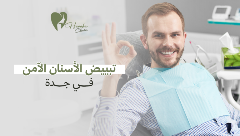 تبييض الأسنان الآمن في جدة