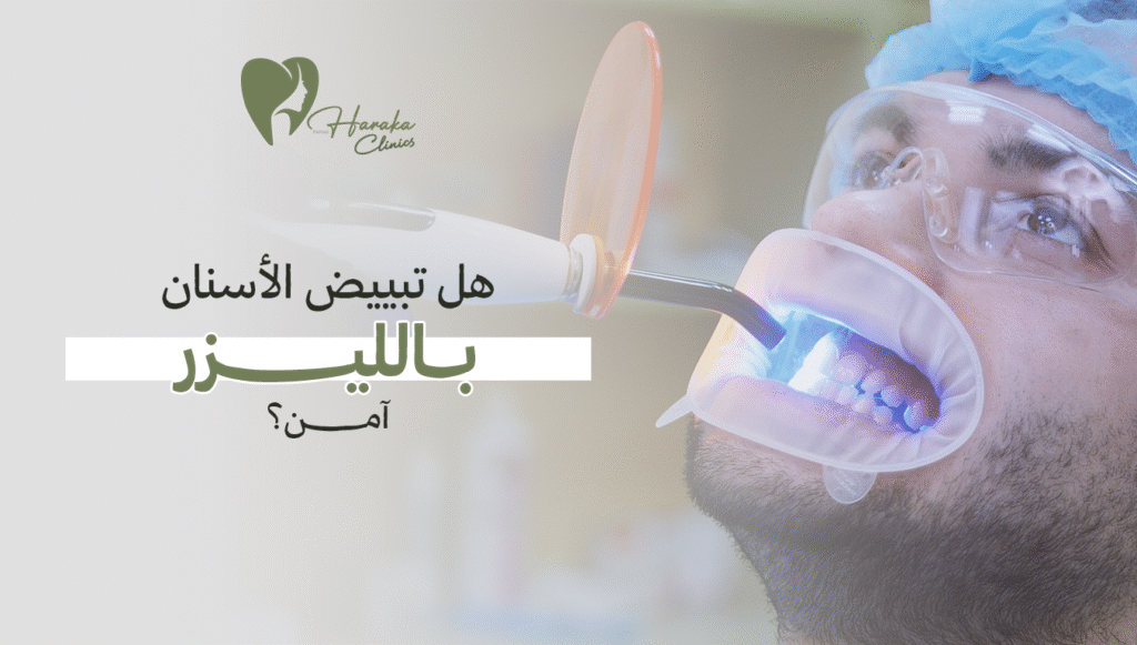 هل تبييض الأسنان بالليزر آمن؟ – احصل على إجابات وحجز استشارة