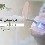 هل تبييض الأسنان بالليزر آمن؟