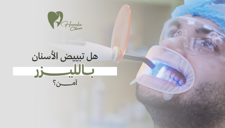 هل تبييض الأسنان بالليزر آمن؟