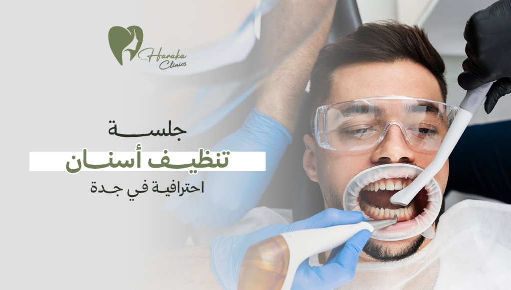 جلسة تنظيف أسنان احترافية جدة | لأعلى مستويات النظافة والصحة