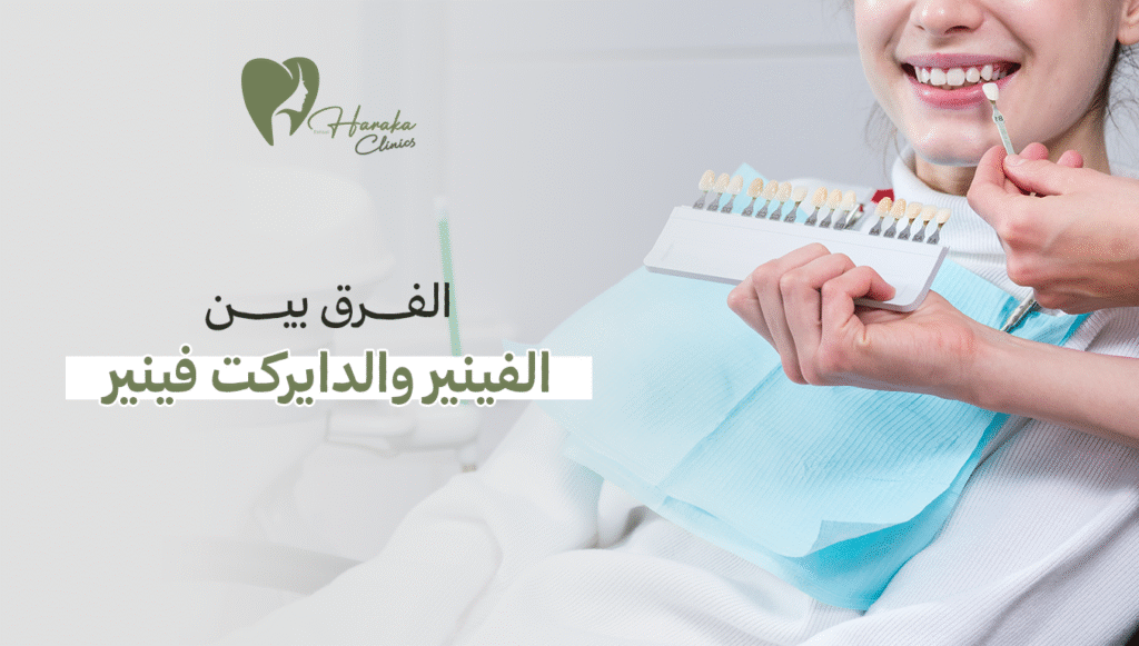 الفرق بين الفينير والدايركت فينير, اختيارك المثالي لابتسامة مذهلة