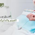 الفرق بين الفينير والدايركت فينير