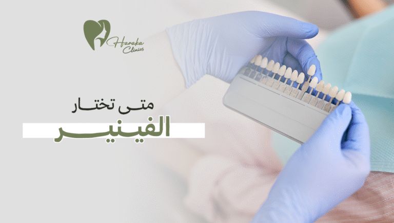 متى تختار الفينير؟