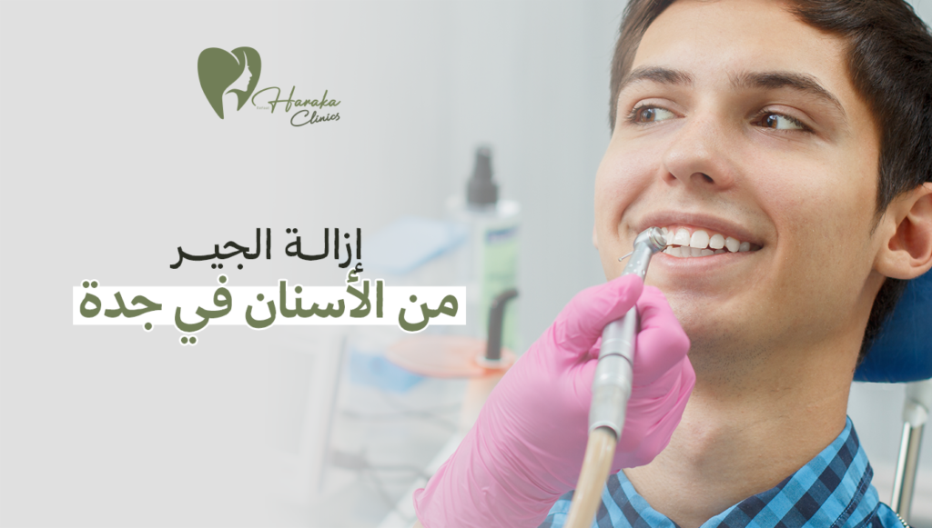 إزالة الجير من الأسنان في جدة | ابتسامة صحية بدون جير