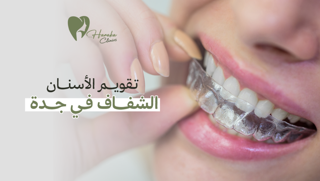 تقويم الأسنان الشفاف في جدة