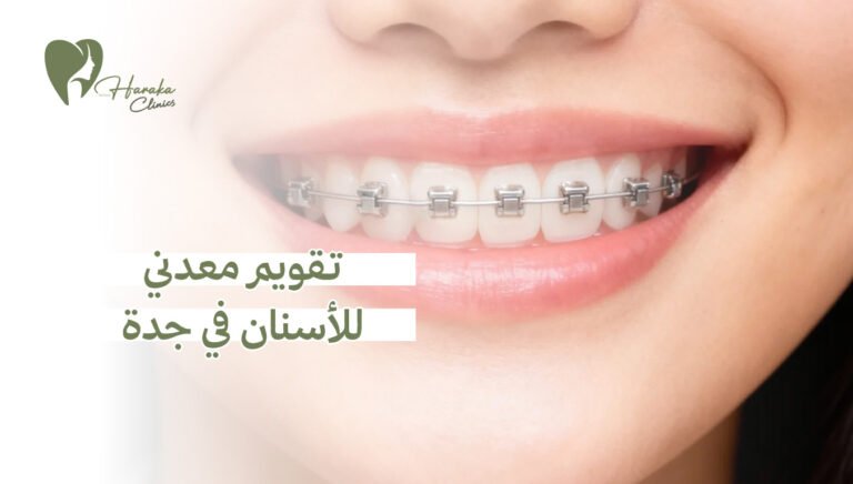 تقويم معدني للأسنان في جدة