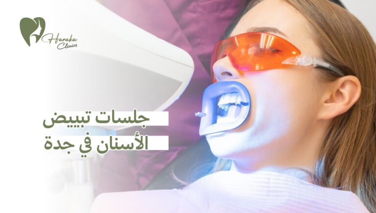 جلسات تبييض الأسنان في جدة