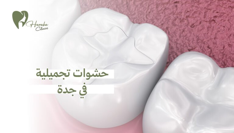 حشوات تجميلية في جدة