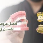 أفضل عروض تقويم الأسنان في جدة