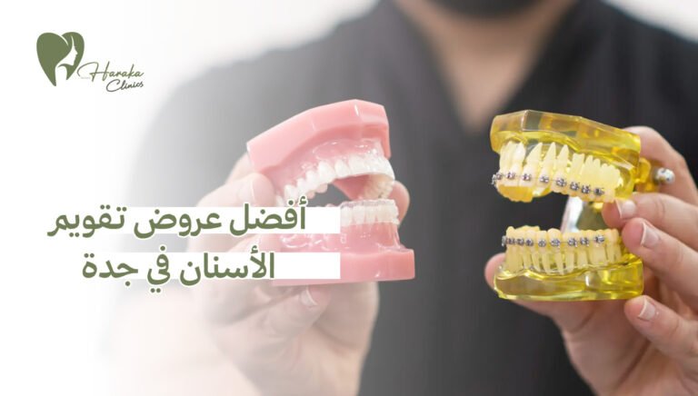 أفضل عروض تقويم الأسنان في جدة