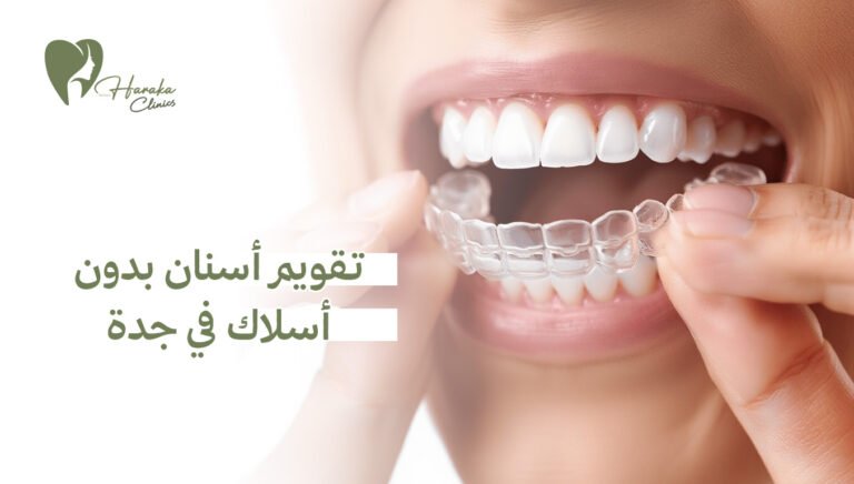تقويم أسنان بدون أسلاك في جدة