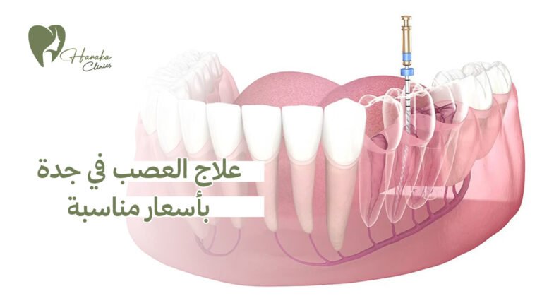 علاج العصب في جدة بأسعار مناسبة