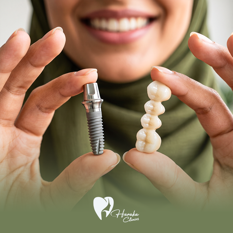 زراعة وتعويض الأسنان