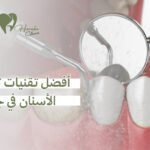 أفضل تقنيات تنظيف الأسنان في جدة