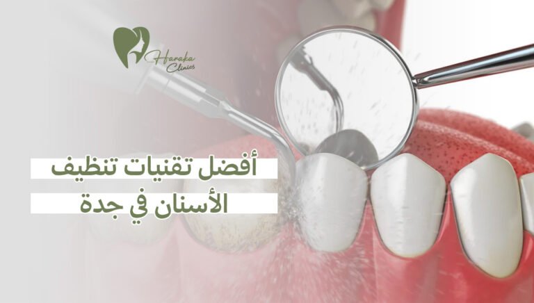 أفضل تقنيات تنظيف الأسنان في جدة