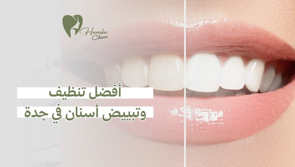 أفضل تنظيف وتبييض أسنان في جدة