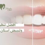 أفضل تنظيف وتبييض أسنان في جدة