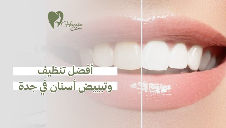 أفضل تنظيف وتبييض أسنان في جدة