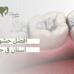 أفضل حشوات أسنان في جدة