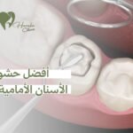 أفضل حشوات الأسنان الأمامية في جدة