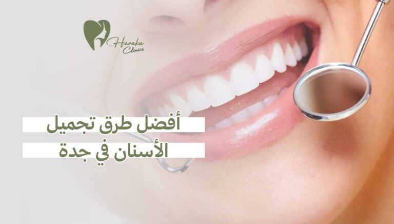 أفضل طرق تجميل الأسنان في جدة