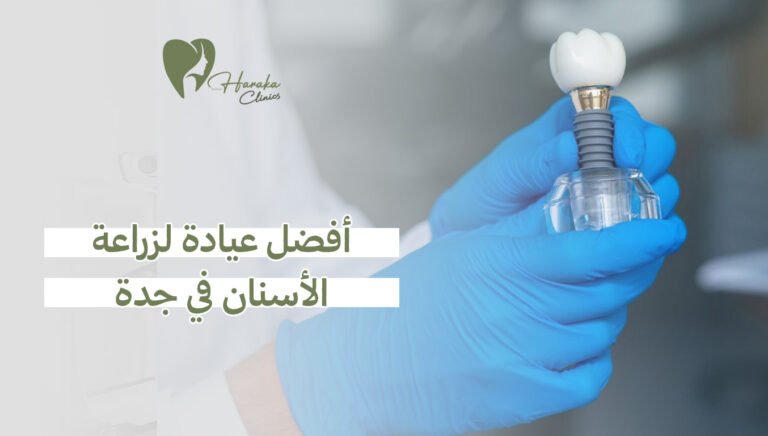 أفضل عيادة لزراعة الأسنان في جدة