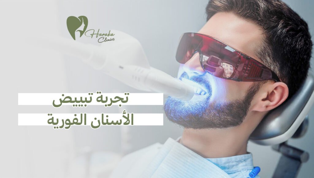 تجربة تبييض الأسنان الفورية
