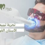 تجربة تبييض الأسنان الفورية