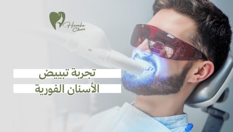 تجربة تبييض الأسنان الفورية